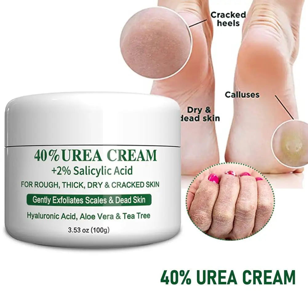 Urea Repair Cream 100g — Feet & Hands Rescue